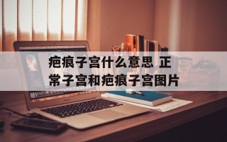 疤痕子宫什么意思 正常子宫和疤痕子宫图片